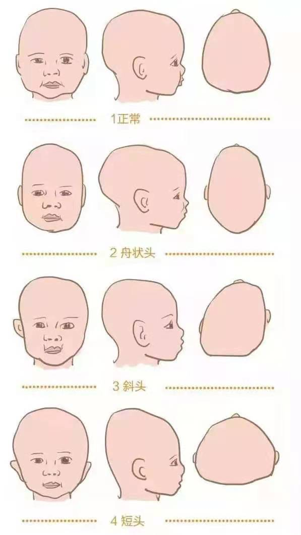 扁头是天生的,还是睡出来的?__财经头条