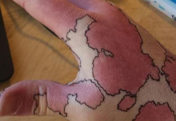 男子天生满手胎记,用笔简单一画,朋友纷纷羡慕不已!