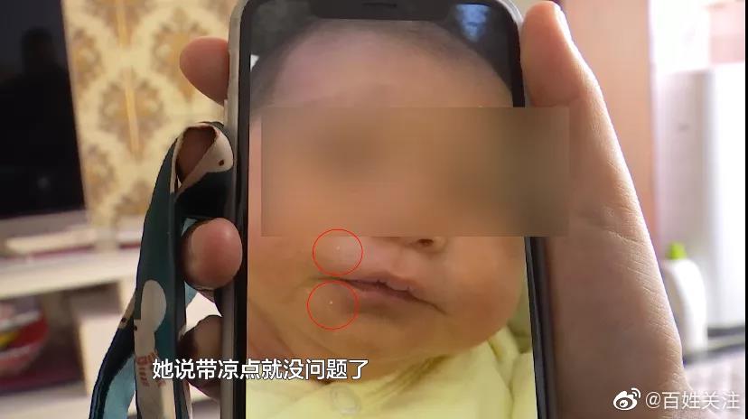 家长称月嫂不专业致婴儿皮肤受损：长了湿疹却说不需要擦药休闲区蓝鸢梦想 - Www.slyday.coM