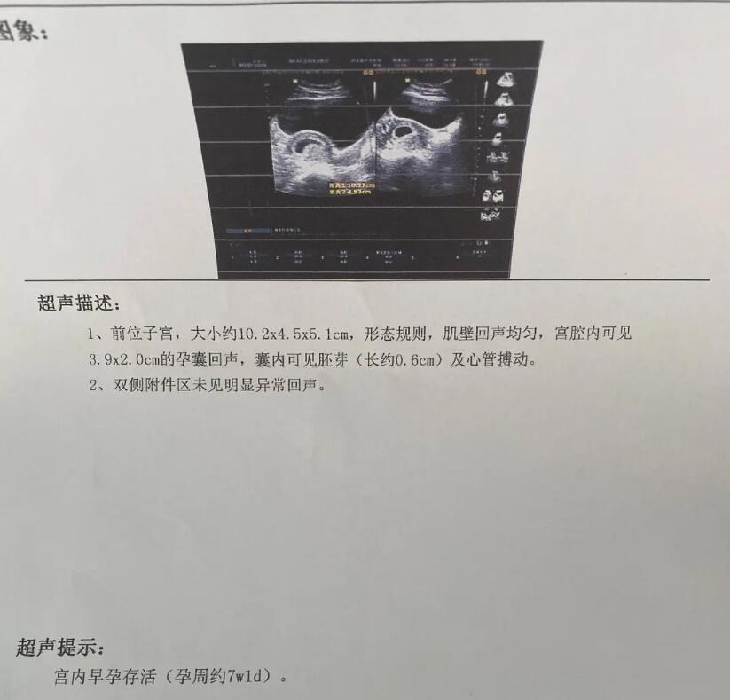 女生自曝被西安建筑科技大学院长之子长期PUA,伤痕累累触目惊心休闲区蓝鸢梦想 - Www.slyday.coM 女生自曝被西安建筑科技大学院长之子长期PUA,伤痕累累触目惊心休闲区蓝鸢梦想 - Www.slyday.coM