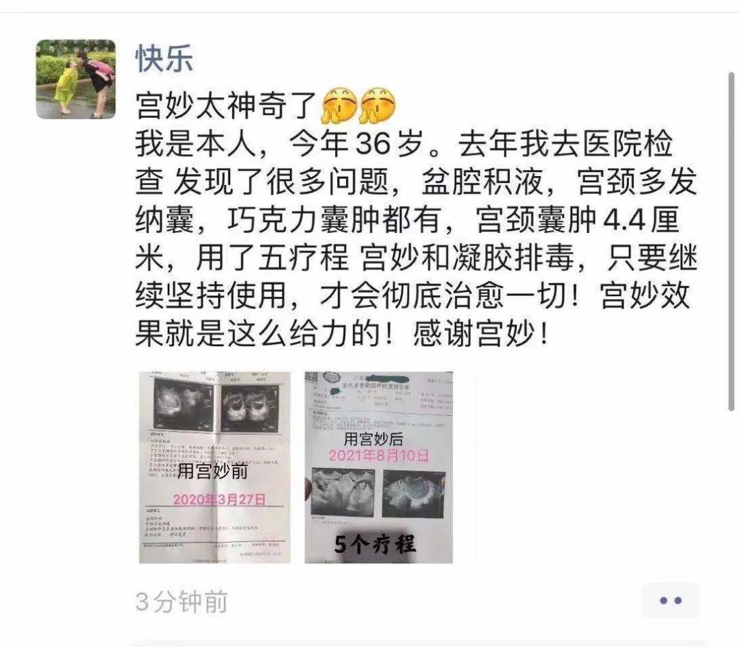起底微商宫妙：股权激励、夸大宣传、多层次计酬(图7)