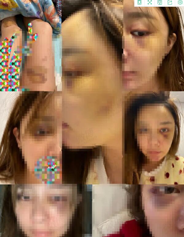 女生自曝被西安建筑科技大学院长之子长期PUA,伤痕累累触目惊心休闲区蓝鸢梦想 - Www.slyday.coM 女生自曝被西安建筑科技大学院长之子长期PUA,伤痕累累触目惊心休闲区蓝鸢梦想 - Www.slyday.coM