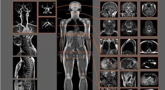 可以帮助我们清楚的看到人体中的异常,核磁共振的基本原理就是人体