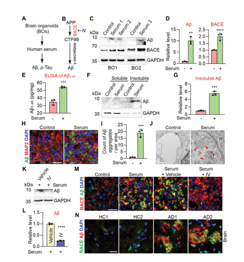 Adv Sci：大脑类器官用于散发性阿尔茨海默病研究|血清|器官|突触_新浪新闻
