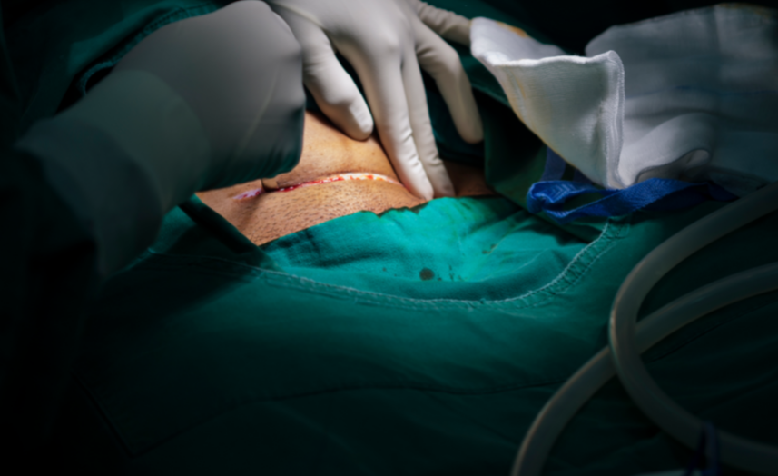 剖宫产or自然分娩,如何选择?|分娩|自然分娩|剖腹产_新浪新闻