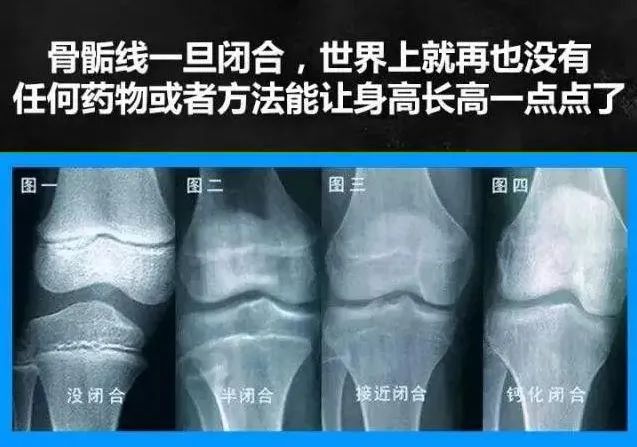 孩子13岁,吃了它,身高永远停在了1米4