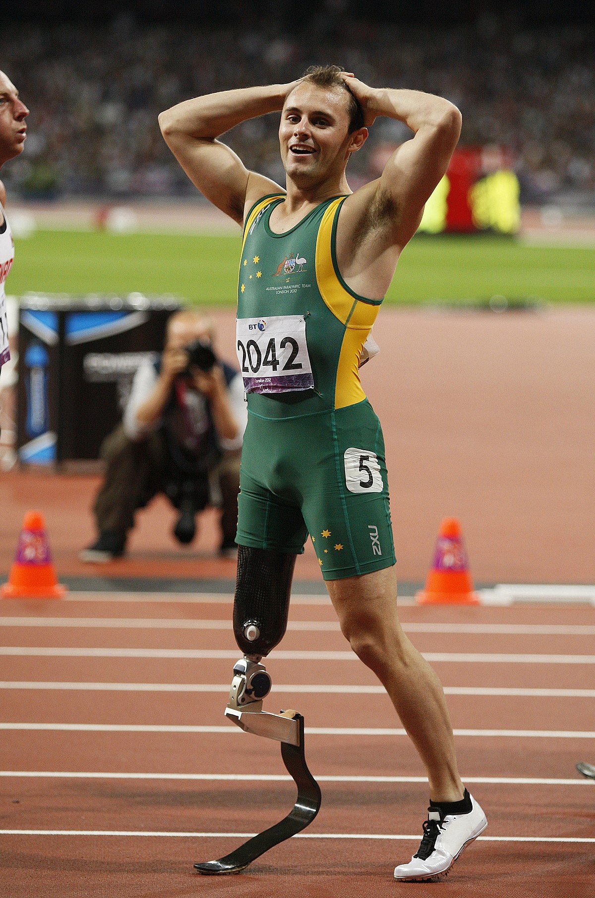 歧视!残奥冠军愤怒发声:夺得金牌无任何奖金 奥运冠军奖金不菲