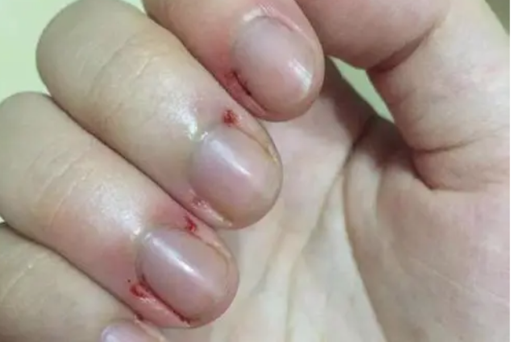 可能不是缺乏维生素,而是在提醒该做这件事了|倒刺|手指|护手霜_新浪