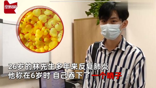男子6岁时吞下一个哨子怕被骂瞒了20年！如今咳得不行了才做手术取出休闲区蓝鸢梦想 - Www.slyday.coM