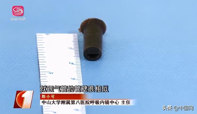 深圳一小伙反复被肺炎折磨,自述6岁那年吞了个哨子,因害怕隐瞒休闲区蓝鸢梦想 - Www.slyday.coM 深圳一小伙反复被肺炎折磨,自述6岁那年吞了个哨子,因害怕隐瞒休闲区蓝鸢梦想 - Www.slyday.coM