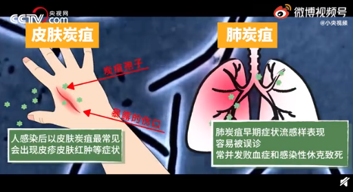 炭疽病毒恶魔种子