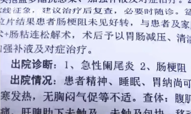 女子肚子疼就医被切除阑尾，术后仍腹痛不止，一查情况惊呆了