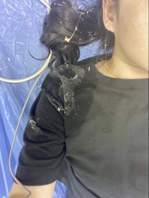 喜茶又出事顾客喝下不明液体入院洗胃