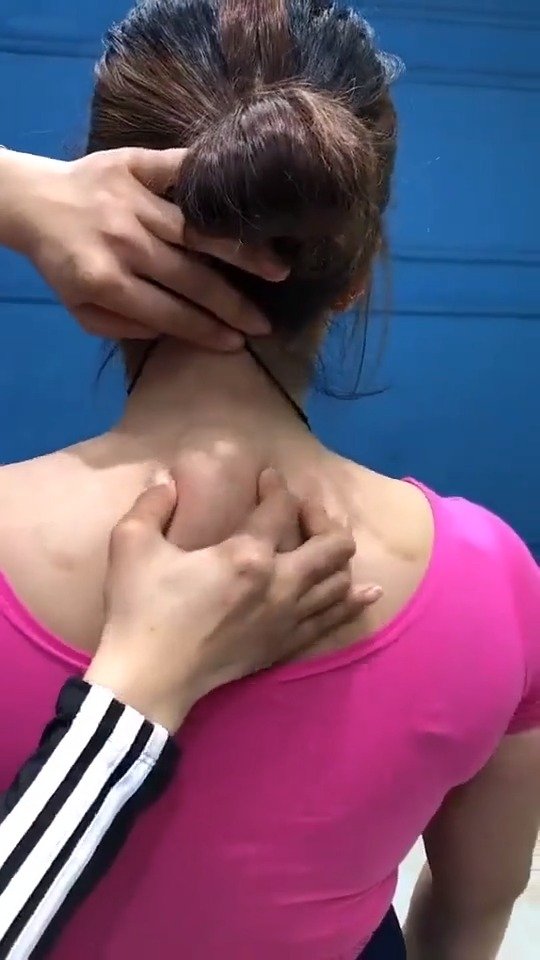 富贵包也叫夺命包,跟我一起锻炼把它消除