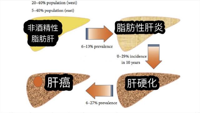 非酒精性脂肪性肝炎有哪些治疗药物