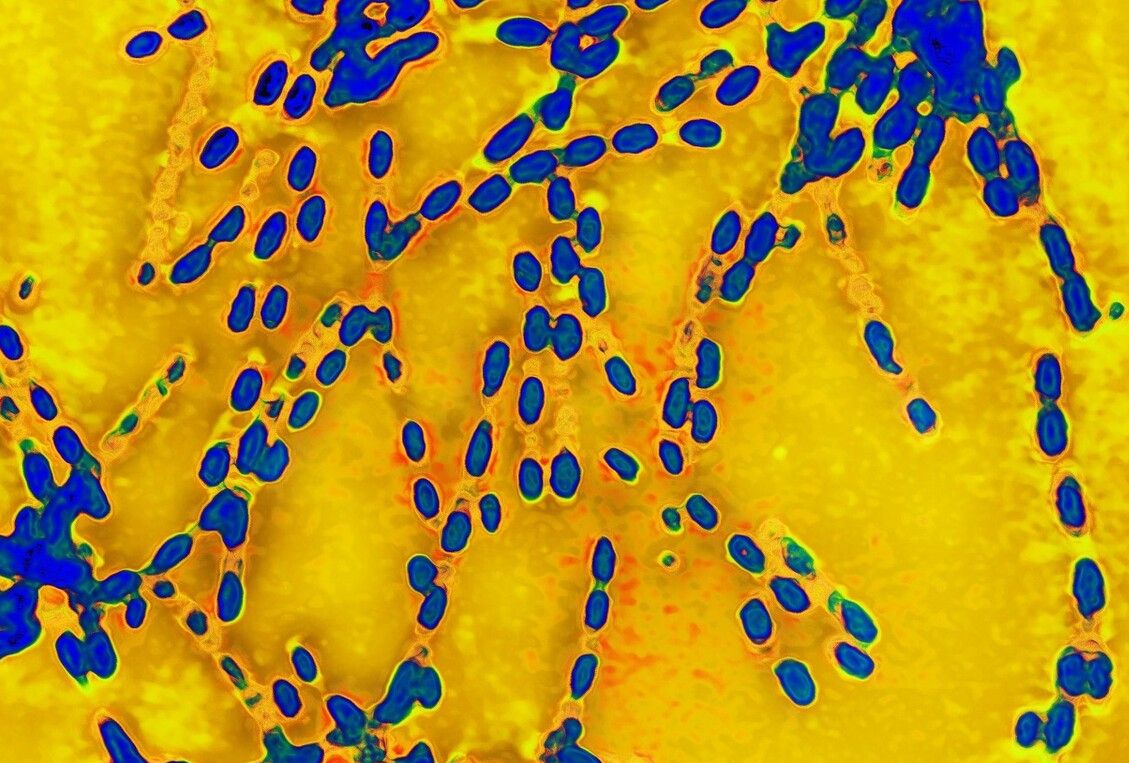 炭疽病是什么感染炭疽杆菌后有什么症状怎么预防炭疽杆菌