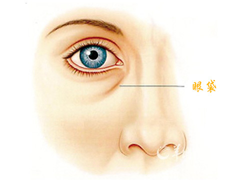 怎么去掉眼袋(怎么去掉眼袋最快最有效)