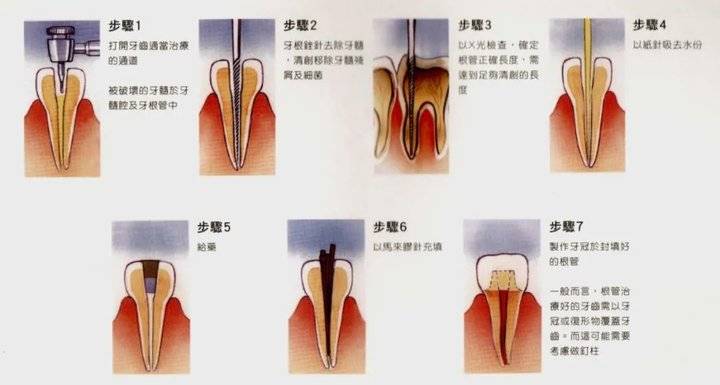 门牙牙神经位置图片图片