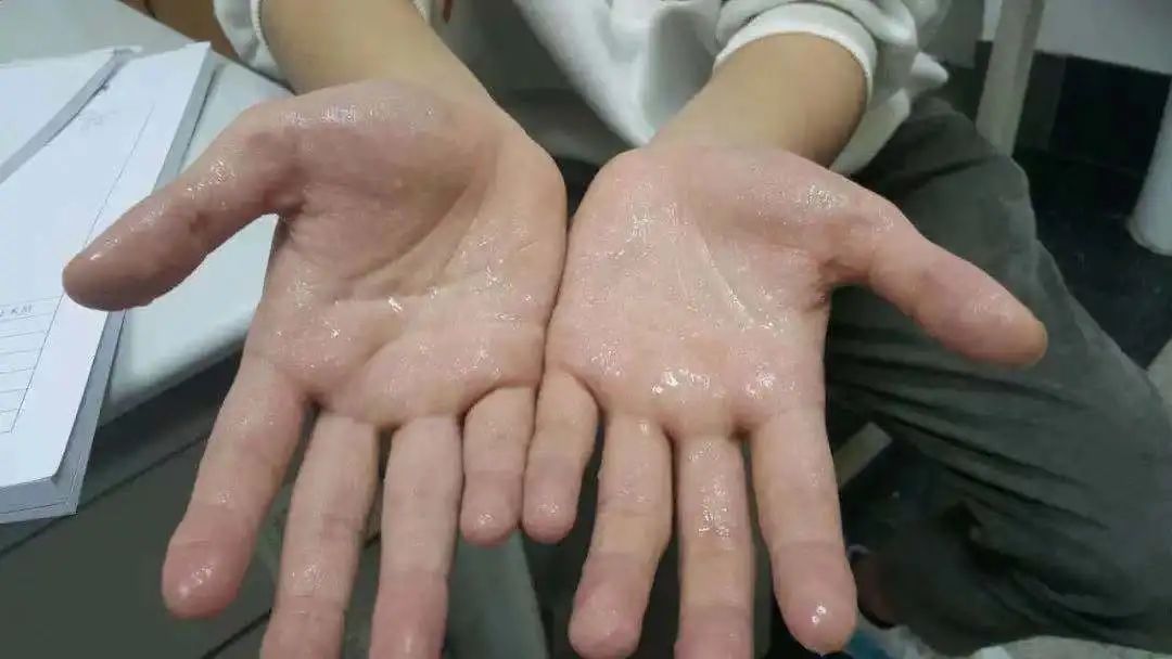 “为啥不牵我的手？”每天被女友逼问！21岁杭州小伙：我太难了休闲区蓝鸢梦想 - Www.slyday.coM