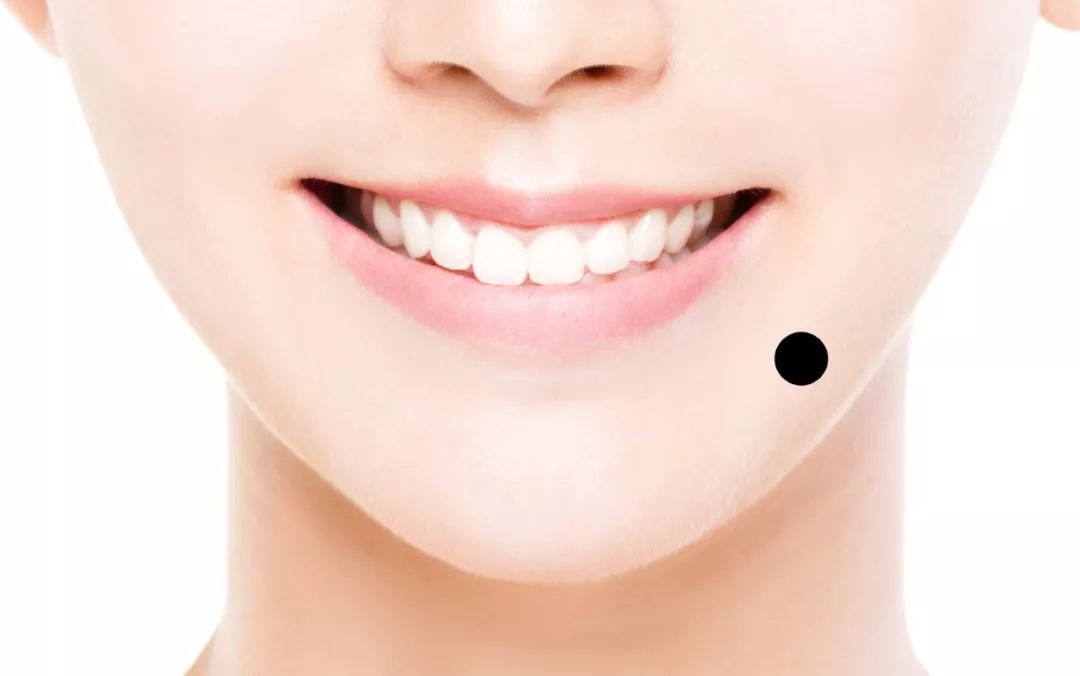 痣位於嘴唇斜外下方,不分左右.