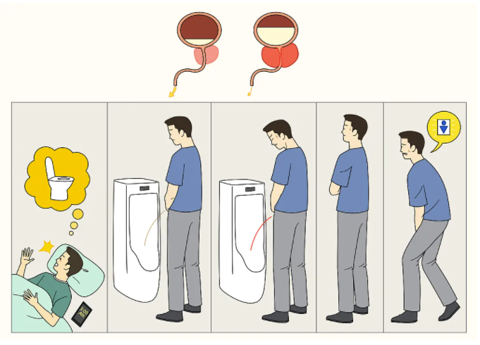 排尿出现这3种异常多半是这个器官在求救转给他吧