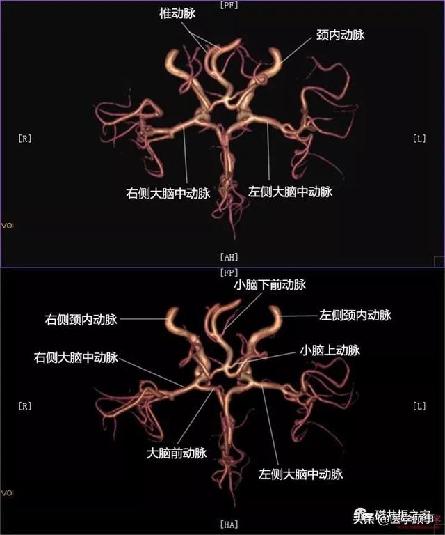 颅内mra解剖及其分段