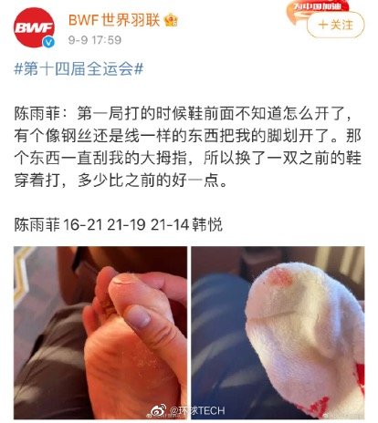 陈雨菲穿李宁鞋比赛脚被割伤  李宁做出回应休闲区蓝鸢梦想 - Www.slyday.coM