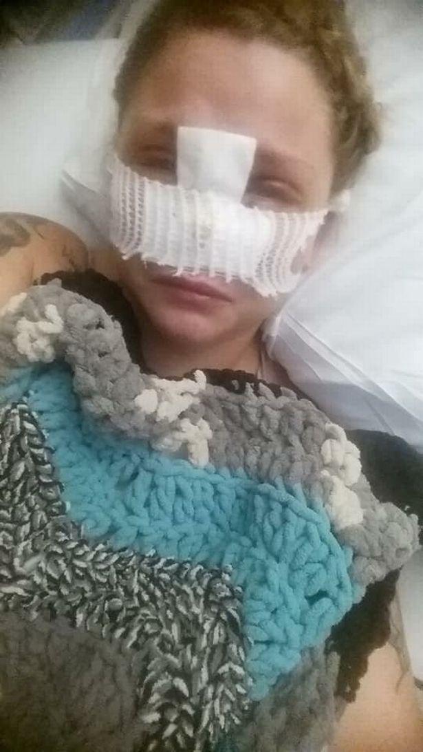 美国女子被朋友的比特犬咬掉鼻子，放弃索赔反而更加宠爱自家狗狗休闲区蓝鸢梦想 - Www.slyday.coM