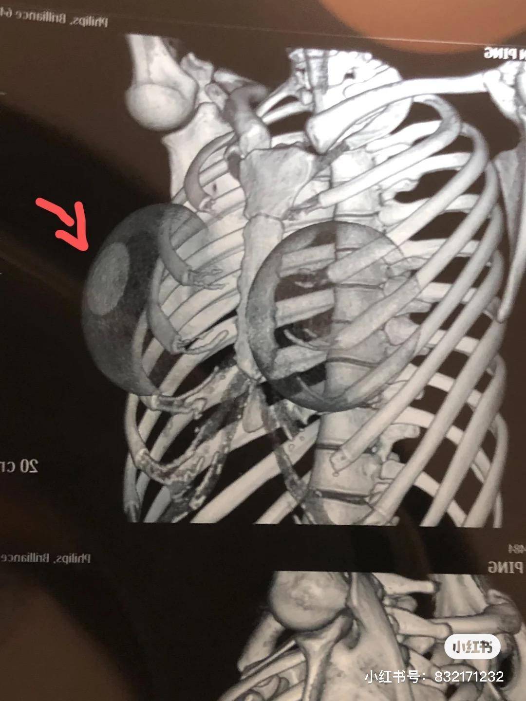 成都整容医院排行_成都一女子整形医院讨说法被打成脑震荡,院方称正配合警方调查