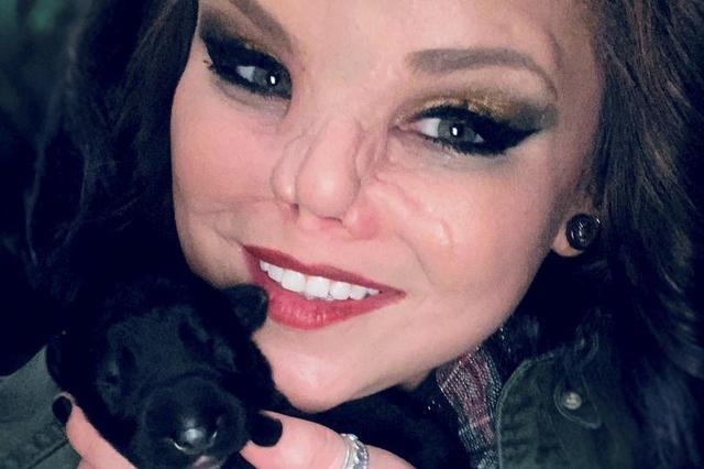 美国女子被朋友的比特犬咬掉鼻子，放弃索赔反而更加宠爱自家狗狗休闲区蓝鸢梦想 - Www.slyday.coM