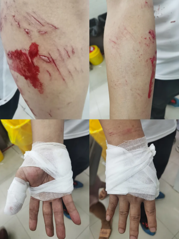 迅速组织扩线侦查,于当日晚23:00又抓获贩毒嫌疑人谢某和吸毒人员王某