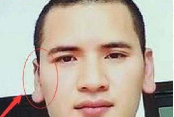 耳垂厚大通常耳垂比较厚大的人,在生活当中财运都非常旺盛,而且个人的