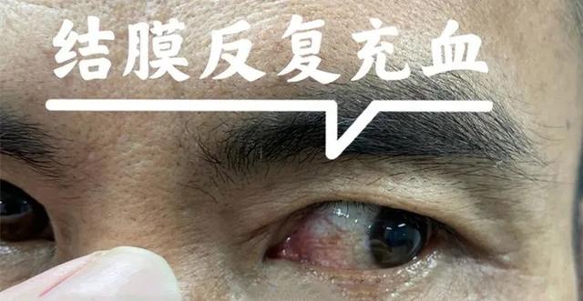 一颗“铁豌豆”在乐东男子眼睛里藏了3年，他竟浑然不知休闲区蓝鸢梦想 - Www.slyday.coM