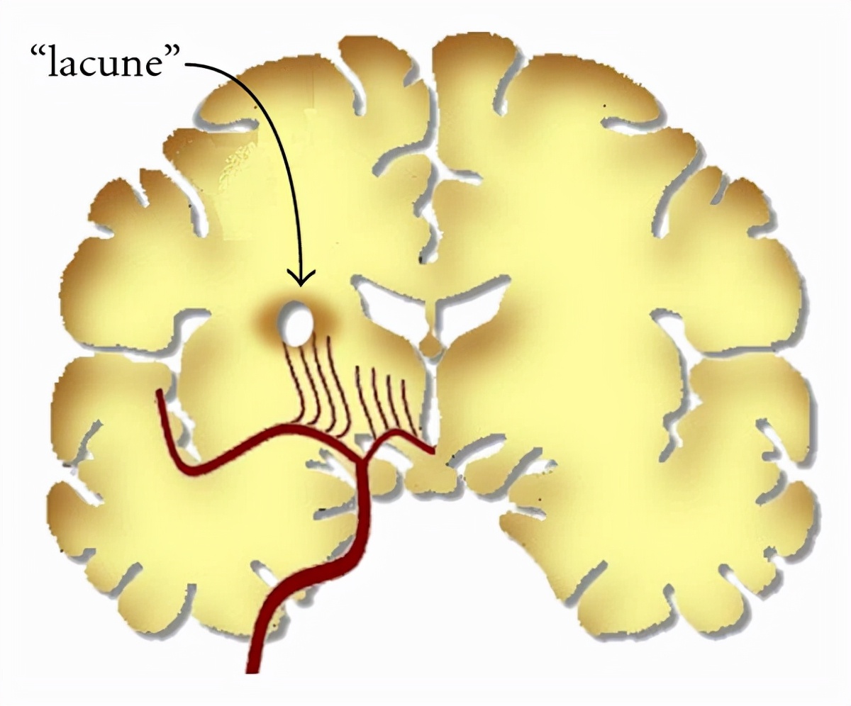 发现大脑有病可以不用治？医生坦言：4种脑病别被骗，不花冤枉钱休闲区蓝鸢梦想 - Www.slyday.coM