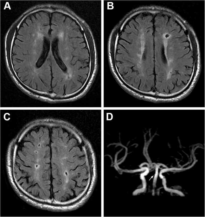 发现大脑有病可以不用治？医生坦言：4种脑病别被骗，不花冤枉钱休闲区蓝鸢梦想 - Www.slyday.coM