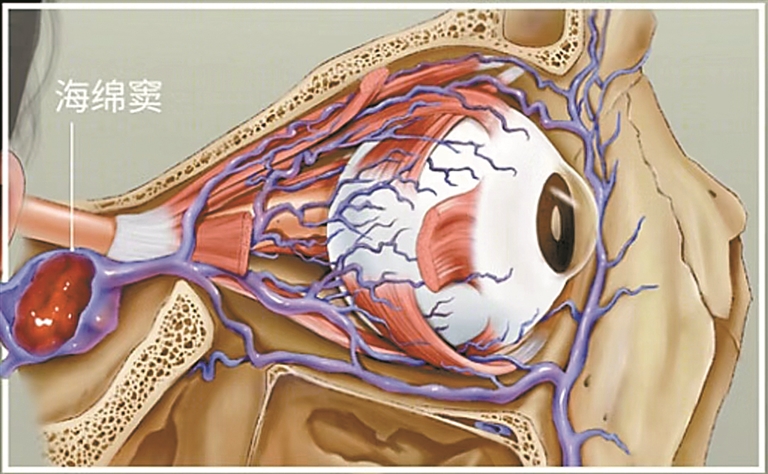 八岁娃频繁挖鼻孔竟致颅内感染休闲区蓝鸢梦想 - Www.slyday.coM