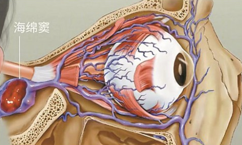 深圳一男童频繁挖鼻孔，竟致颅内感染！大人小孩都要注意休闲区蓝鸢梦想 - Www.slyday.coM