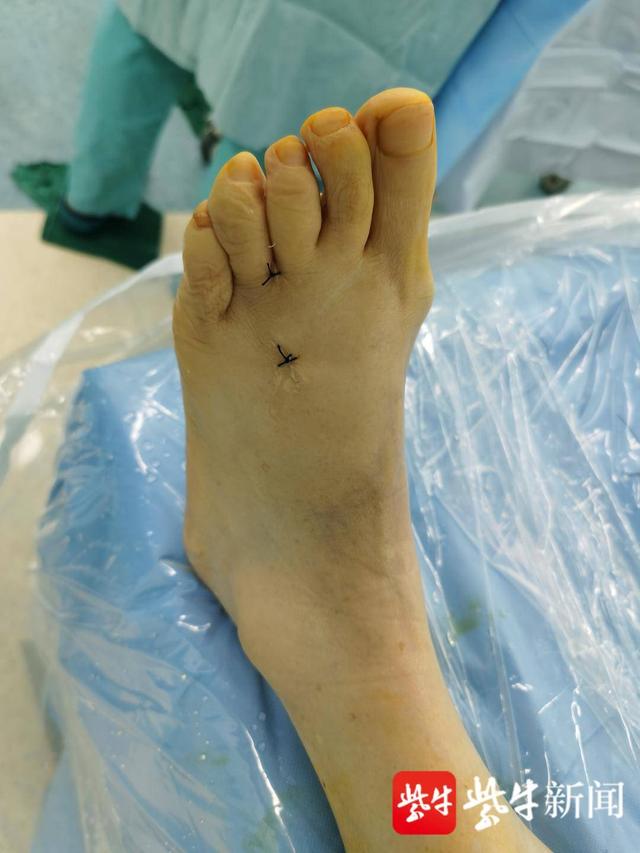 女子脚趾患肿瘤罪魁祸首竟然是它