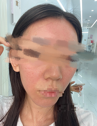 灼伤,律师出面后机构退款了【930新闻眼】|律师到现场|麻药|女士_新浪