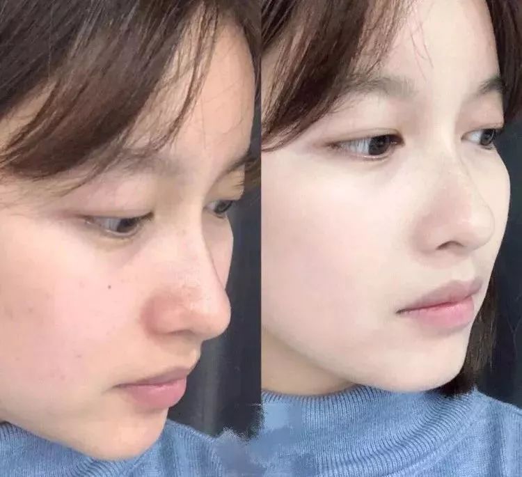 日本顶尖团队70年研发,黑科技美白!1秒提亮,3阶焕白,28天换张皮