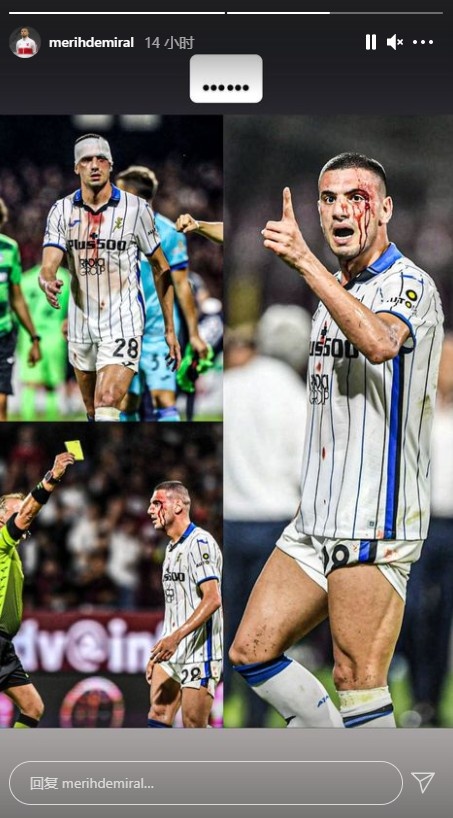 德米拉尔晒眉骨缝针照表达不满：被肘击之后我被出示了一张黄牌！休闲区蓝鸢梦想 - Www.slyday.coM