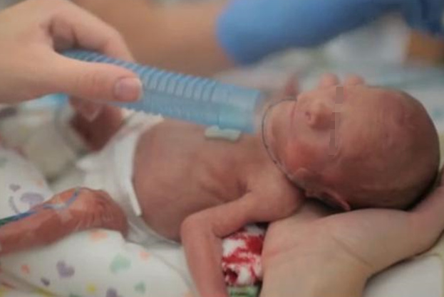 早产儿“七活八不活”？流传多年的说法，表象与现实有很大偏差休闲区蓝鸢梦想 - Www.slyday.coM