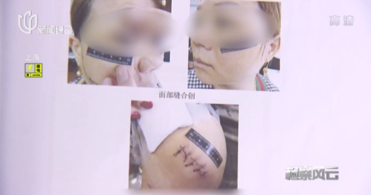 上海一女子被前男友挥刀砍伤，破相后抛弃现男友，选择和前任休闲区蓝鸢梦想 - Www.slyday.coM