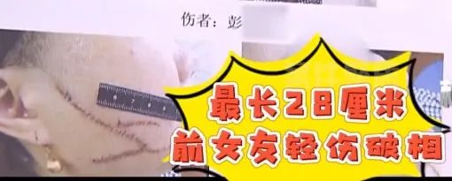 上海一女子被前男友挥刀砍伤，破相后抛弃现男友，选择和前任休闲区蓝鸢梦想 - Www.slyday.coM