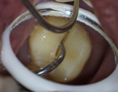 一口下去，7000元没了！这些脸型的人特别注意，每年这时候多发…...休闲区蓝鸢梦想 - Www.slyday.coM