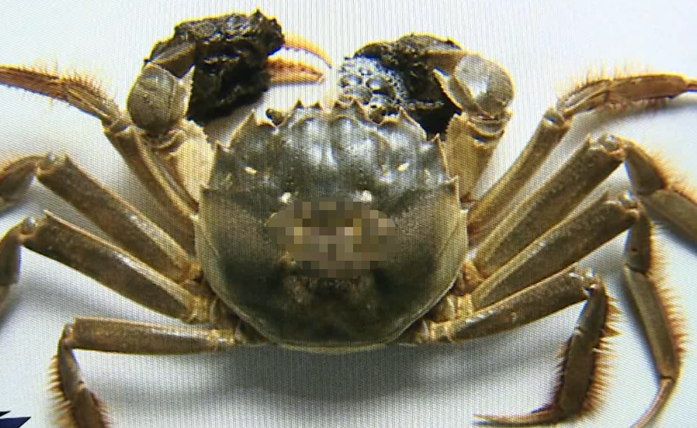 小伙吃螃蟹吃出脑膜炎这种情况要注意