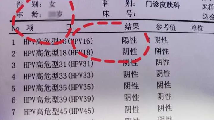 查出高危型hpv感染时咋办