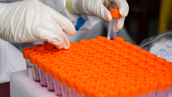 西安至上海高铁一乘客核酸先阳后阴，官方通报：样本在实验室受污染休闲区蓝鸢梦想 - Www.slyday.coM