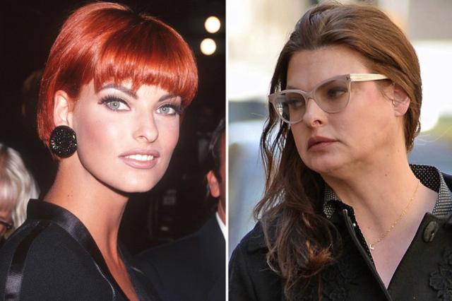 埃万杰利斯塔(linda evangelista)声称,一场整容手术导致她变得"畸形"