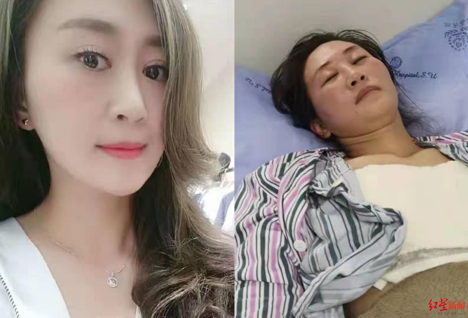 女子打美白针后出现不适四处求医反遭起诉侵权 一审判决：驳回美容院诉讼请求休闲区蓝鸢梦想 - Www.slyday.coM